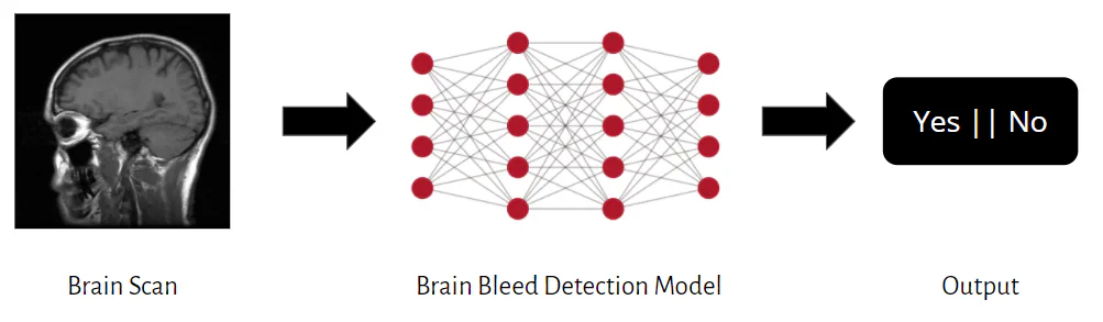 Diagram showing a brain scan processed by a brain bleed detection model that outputs “Yes” or “No”